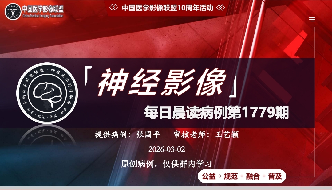 中影神经每日一例 第1779期