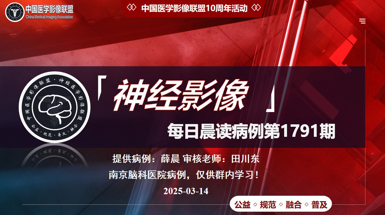 中影神经每日一例第1791期
