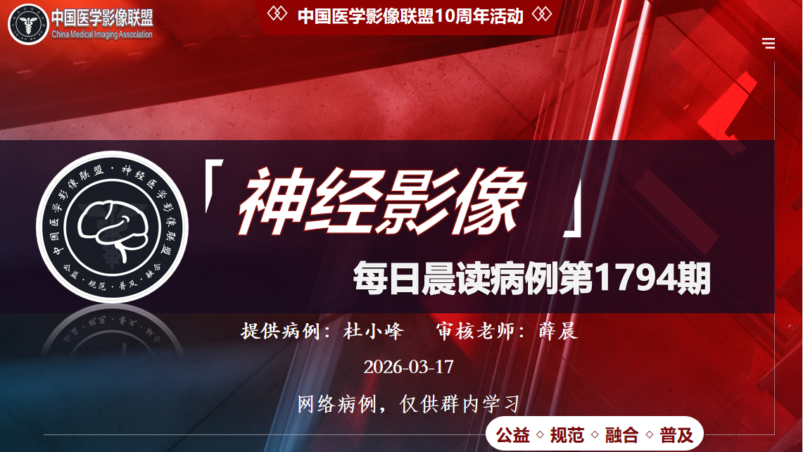 中影神经每日一例第1794期