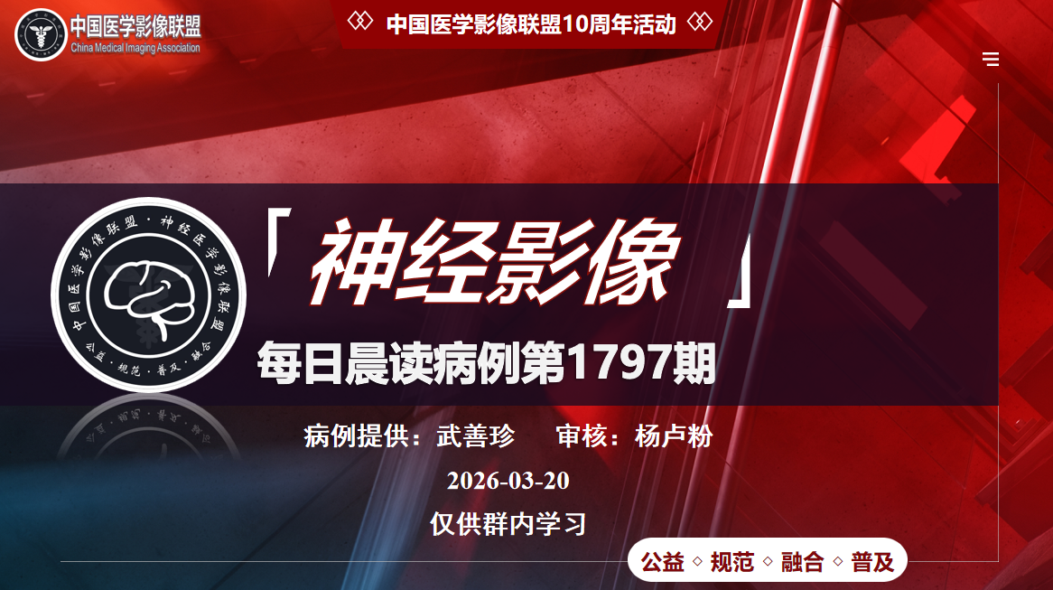 中影神经每日一例第1797期