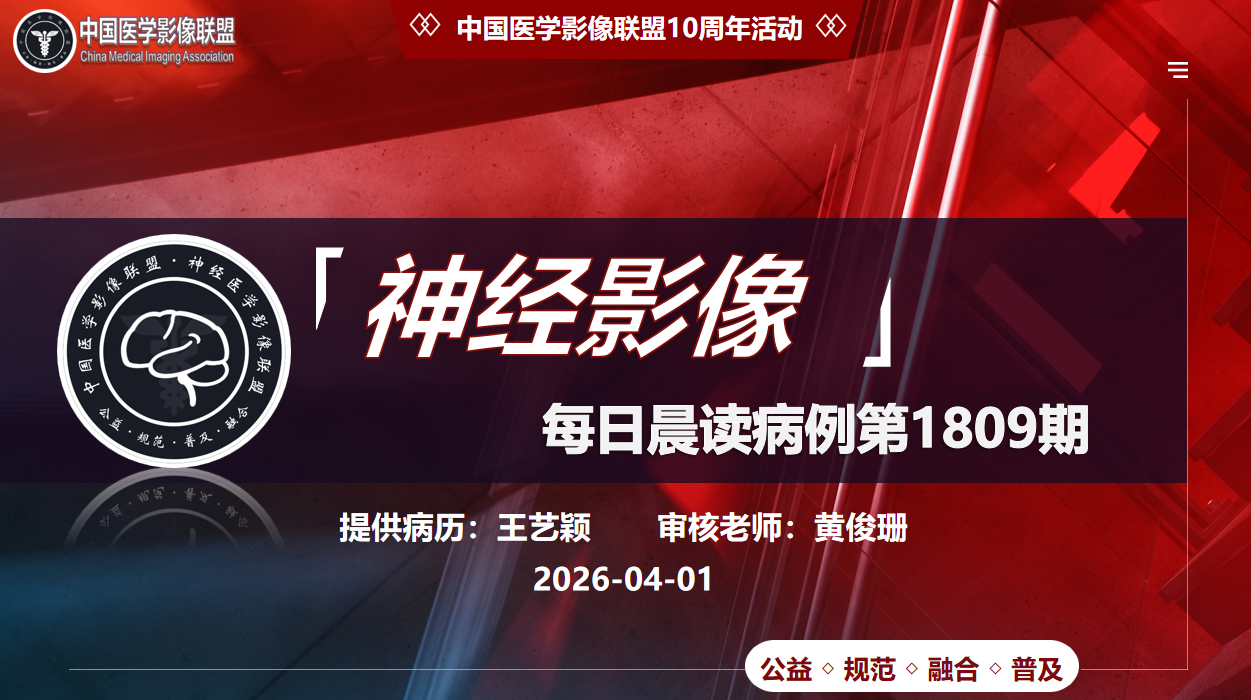 中影神经每日一例第1809期