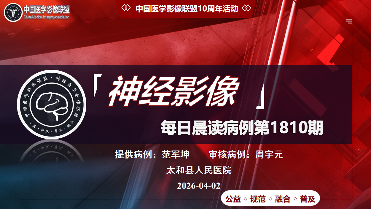 中影神经每日一例第1810期