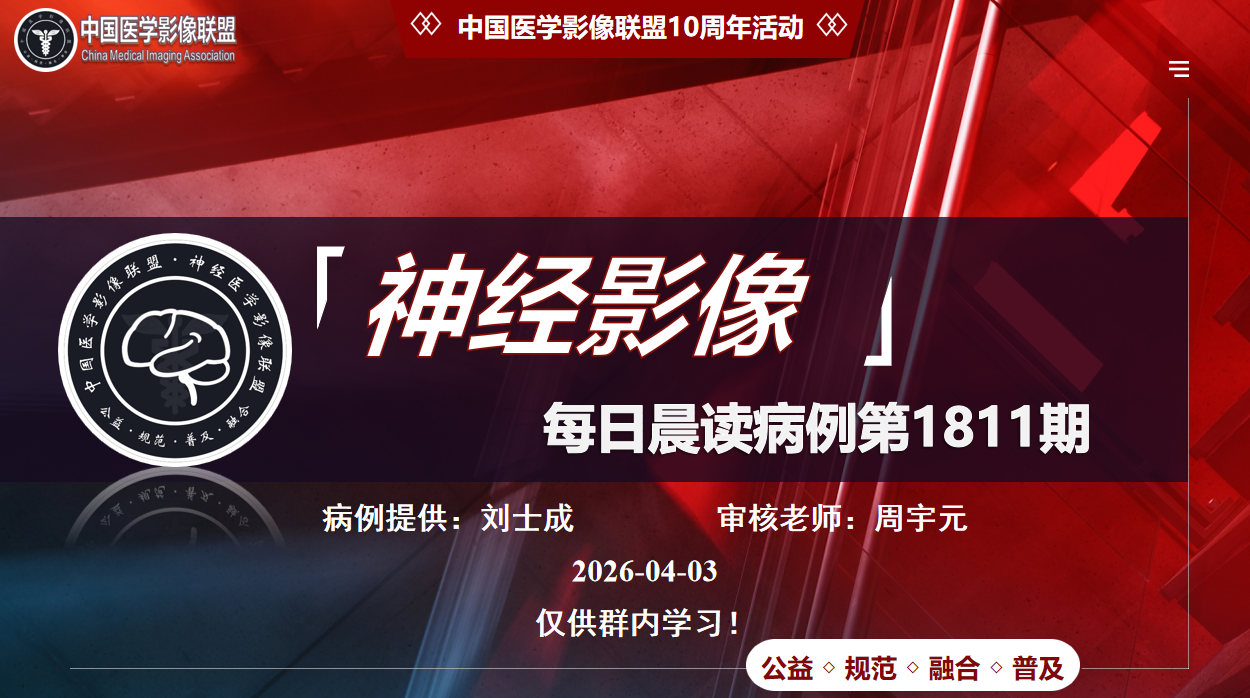 中影神经每日一例第1811期