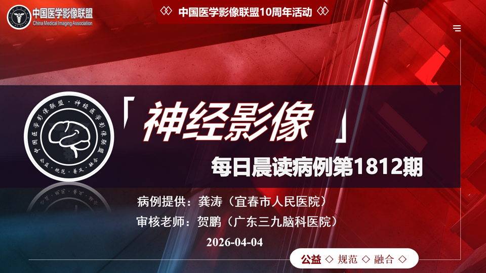 中影神经每日一例第1812期