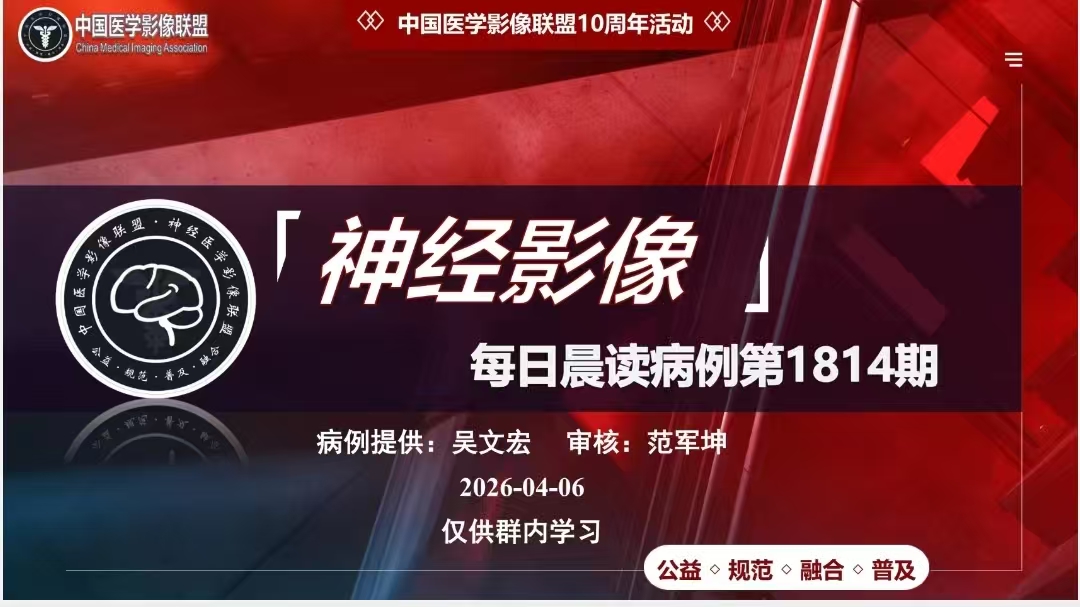 中影神经每日一例第1814期