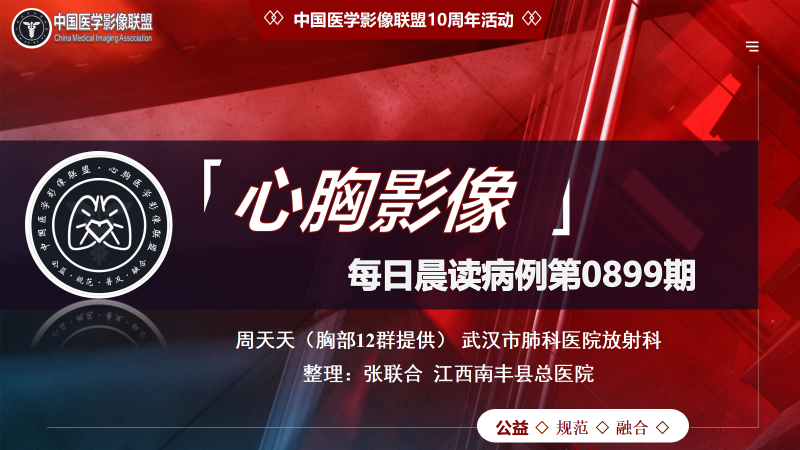中影联盟-胸部病例晨读第0899期