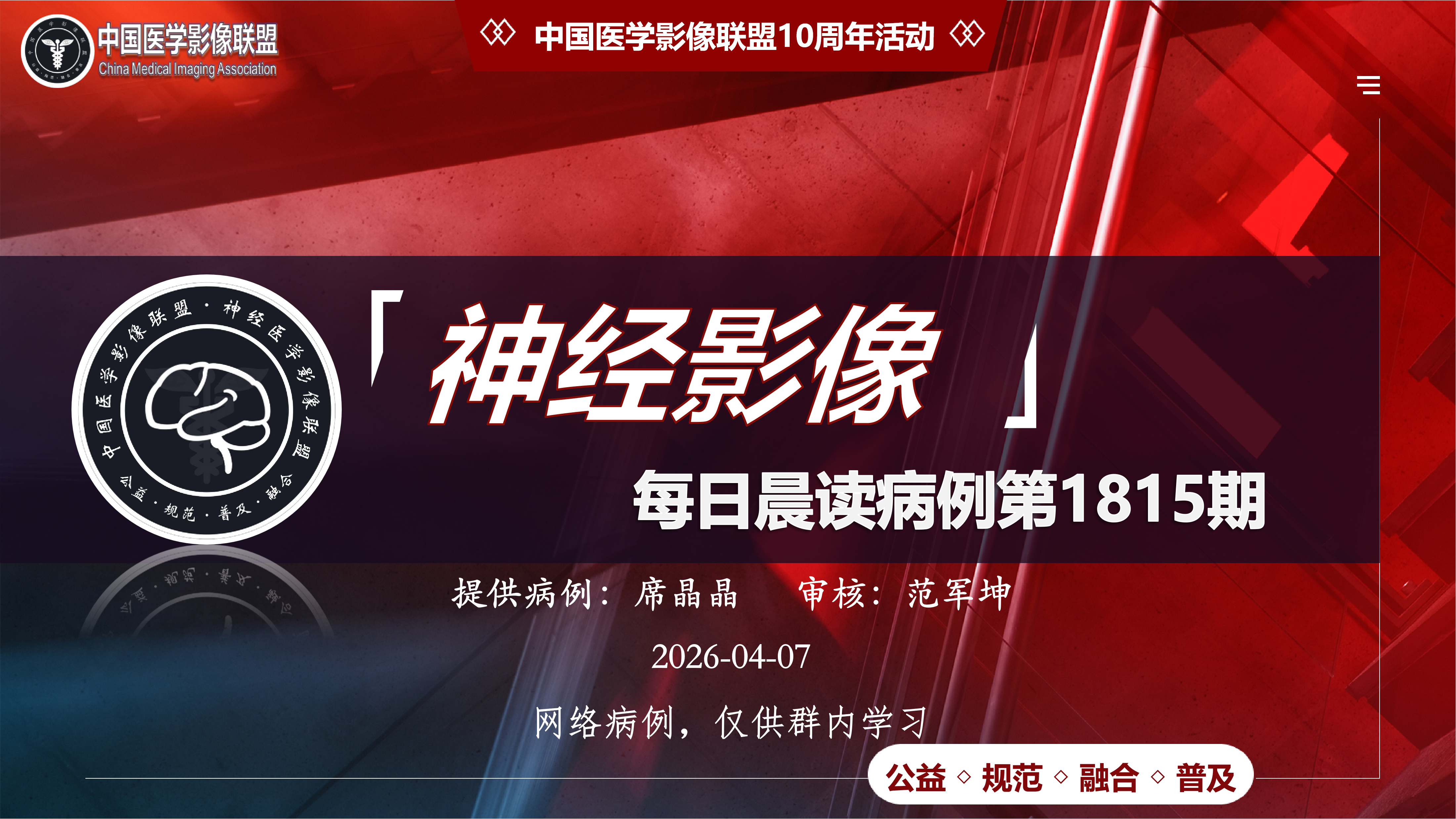 中影神经每日一例第1815期