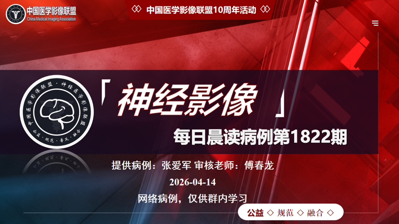 中影神经每日一例第1822期