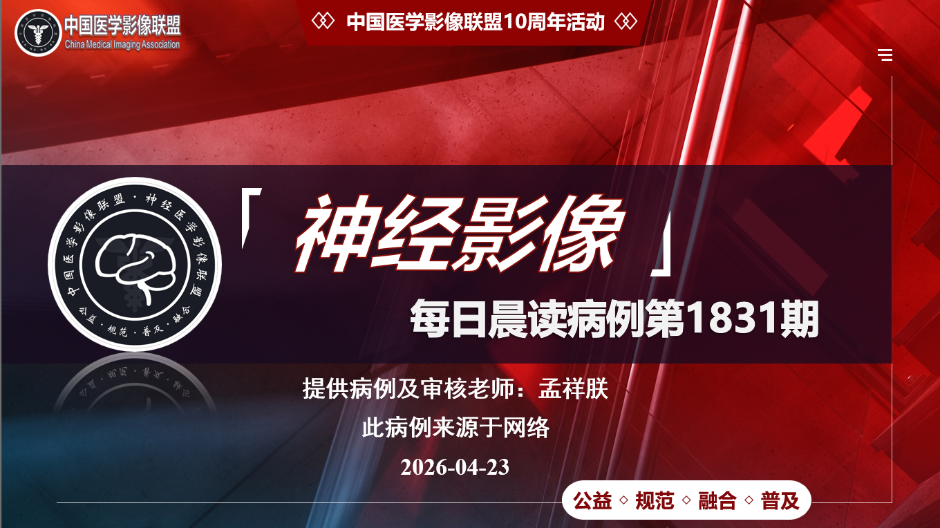 中影每日一例1831期