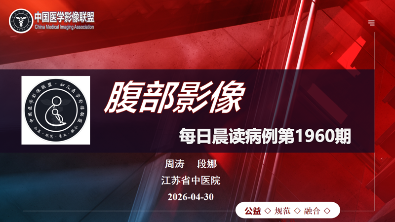 中国医学影像联盟腹部读片2026-04-30第1960期