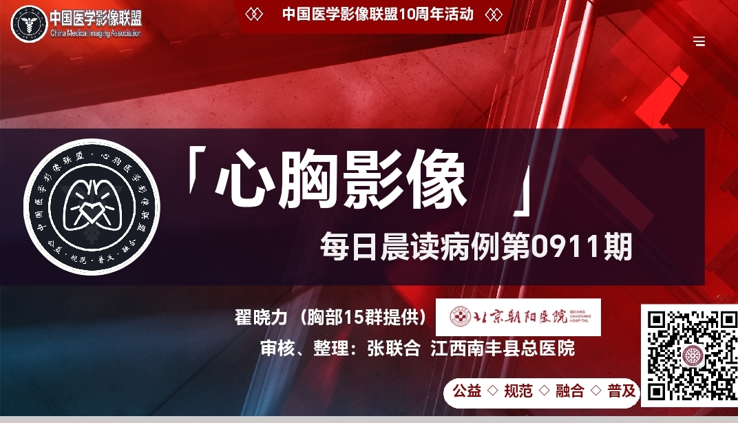 中影联盟-胸部病例晨读第0911期