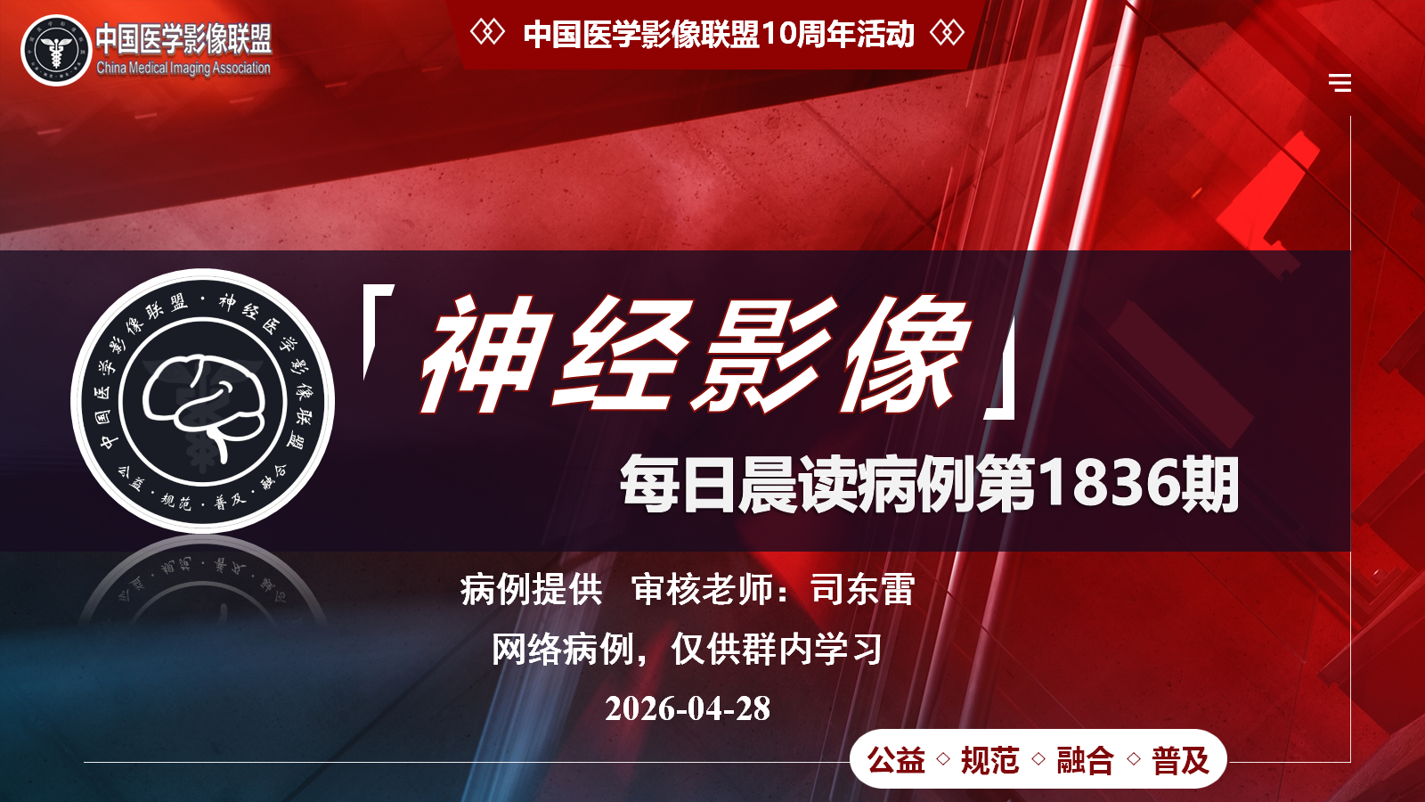 中影神经每日一例第1836期