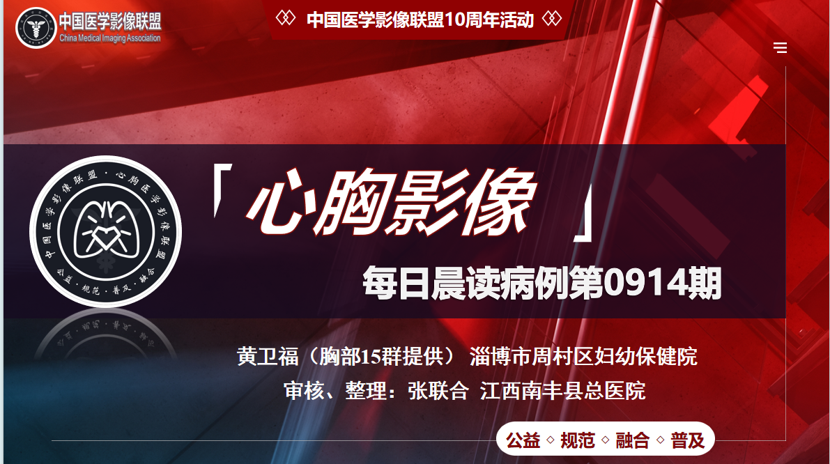 中影联盟-胸部病例晨读第0914期