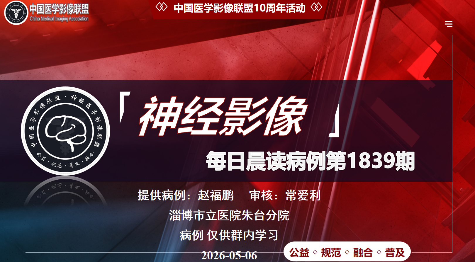 中影神经每日一例第1839期