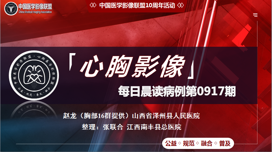 中影联盟-胸部病例晨读第0917期
