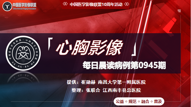 中影联盟-胸部病例晨读第0945期