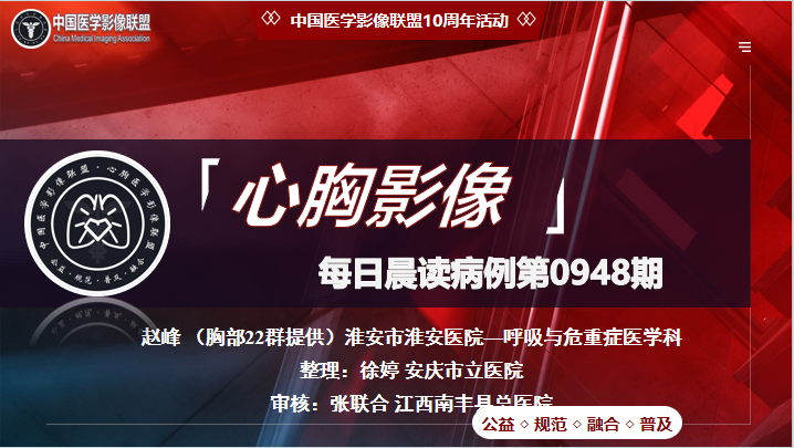 中影联盟-胸部病例晨读第0948期