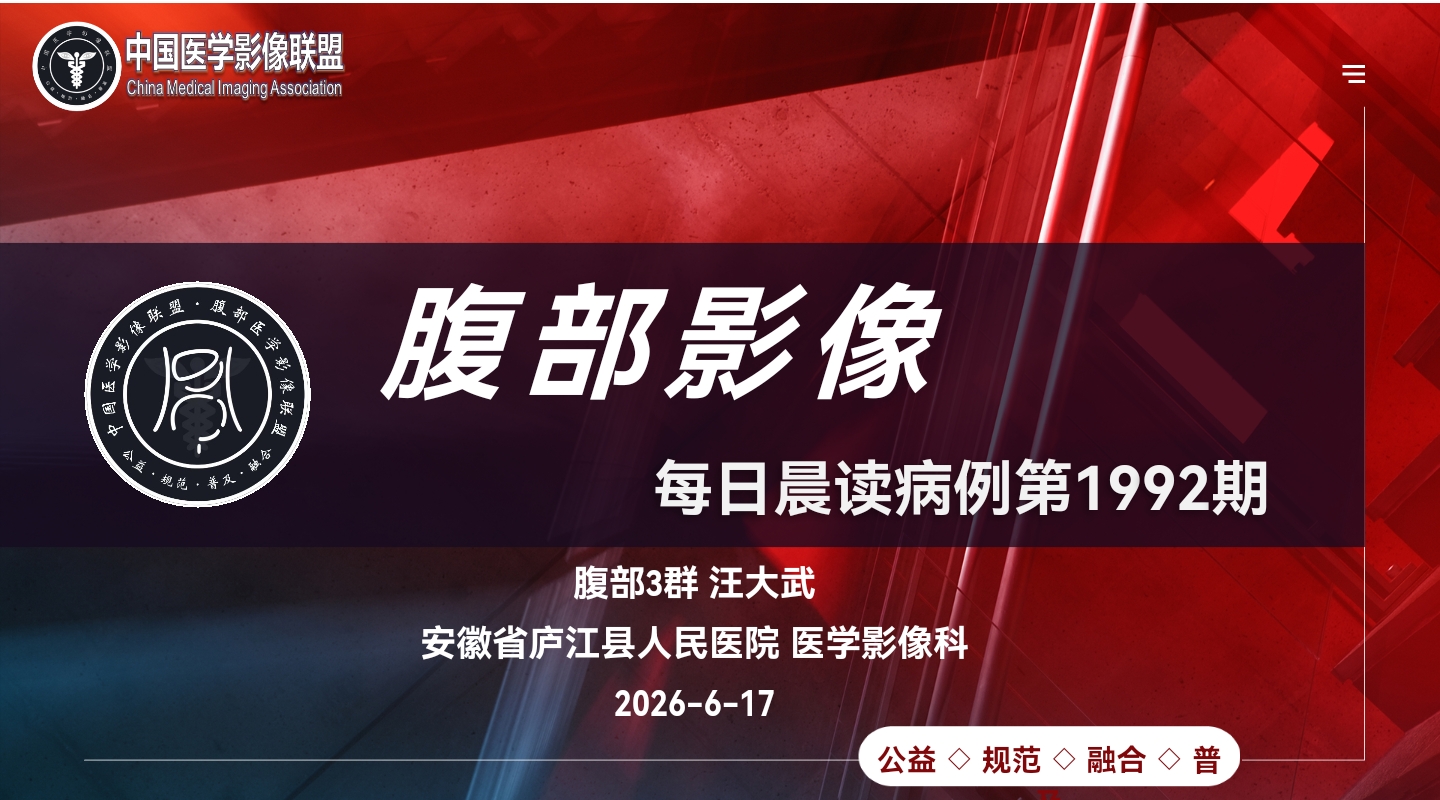 中国医学影像联盟2026—6—17腹部晨读病例