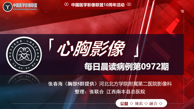 中影联盟-胸部病例晨读第0972期