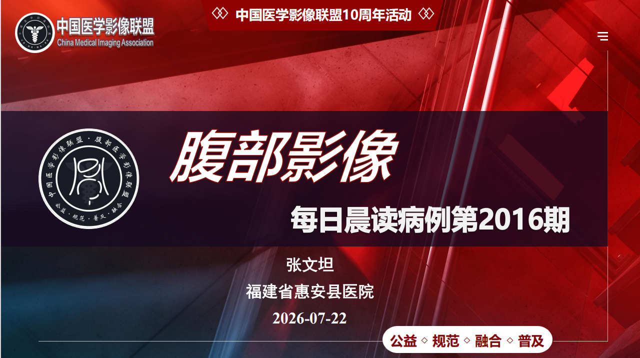中影联盟腹部晨读第2016期​