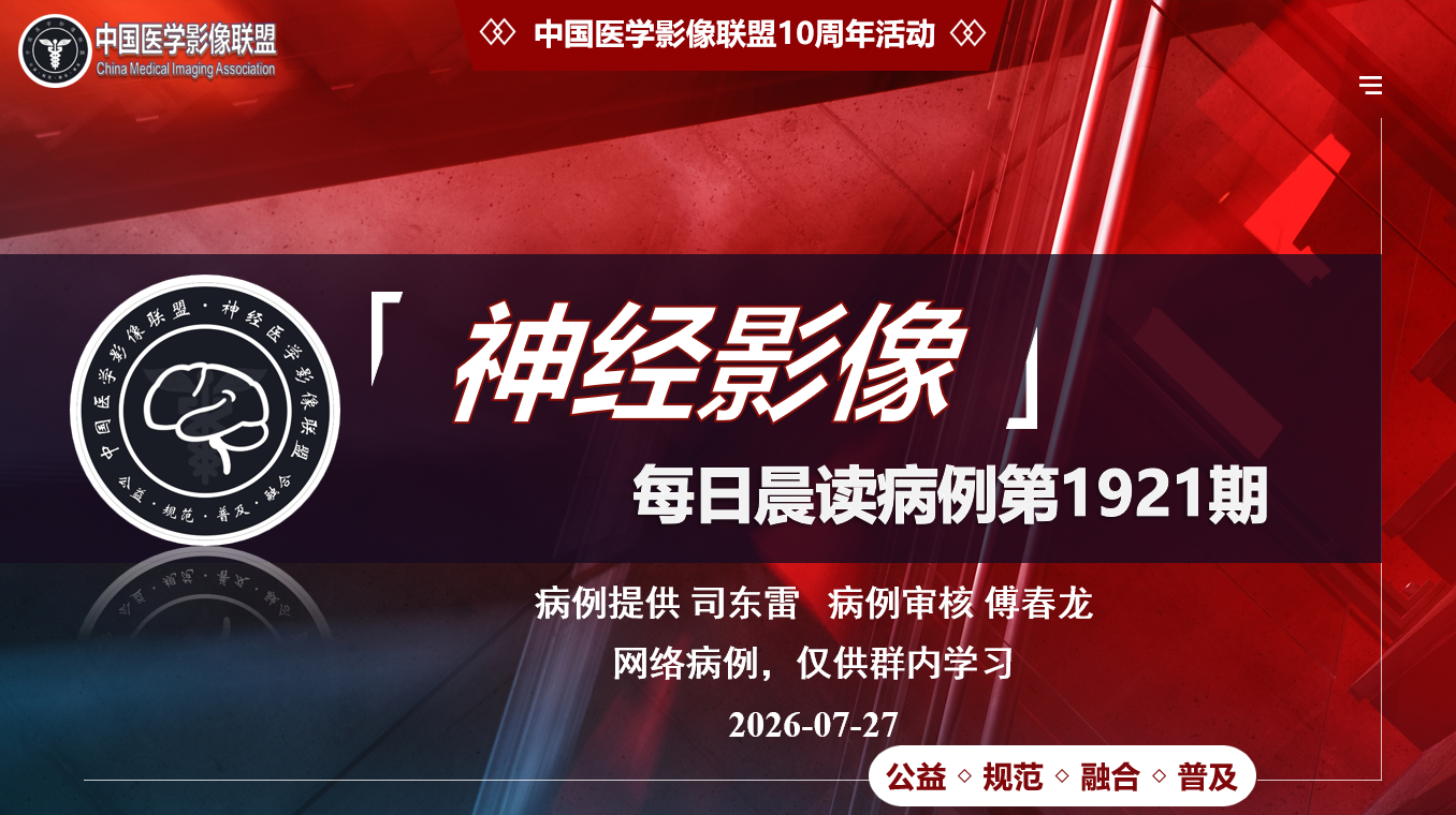 中影神经每日一例第1921期