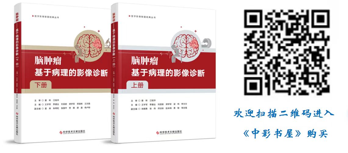 中影神经每日一例第1940期