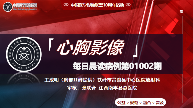 中影联盟-胸部病例晨读第01002期