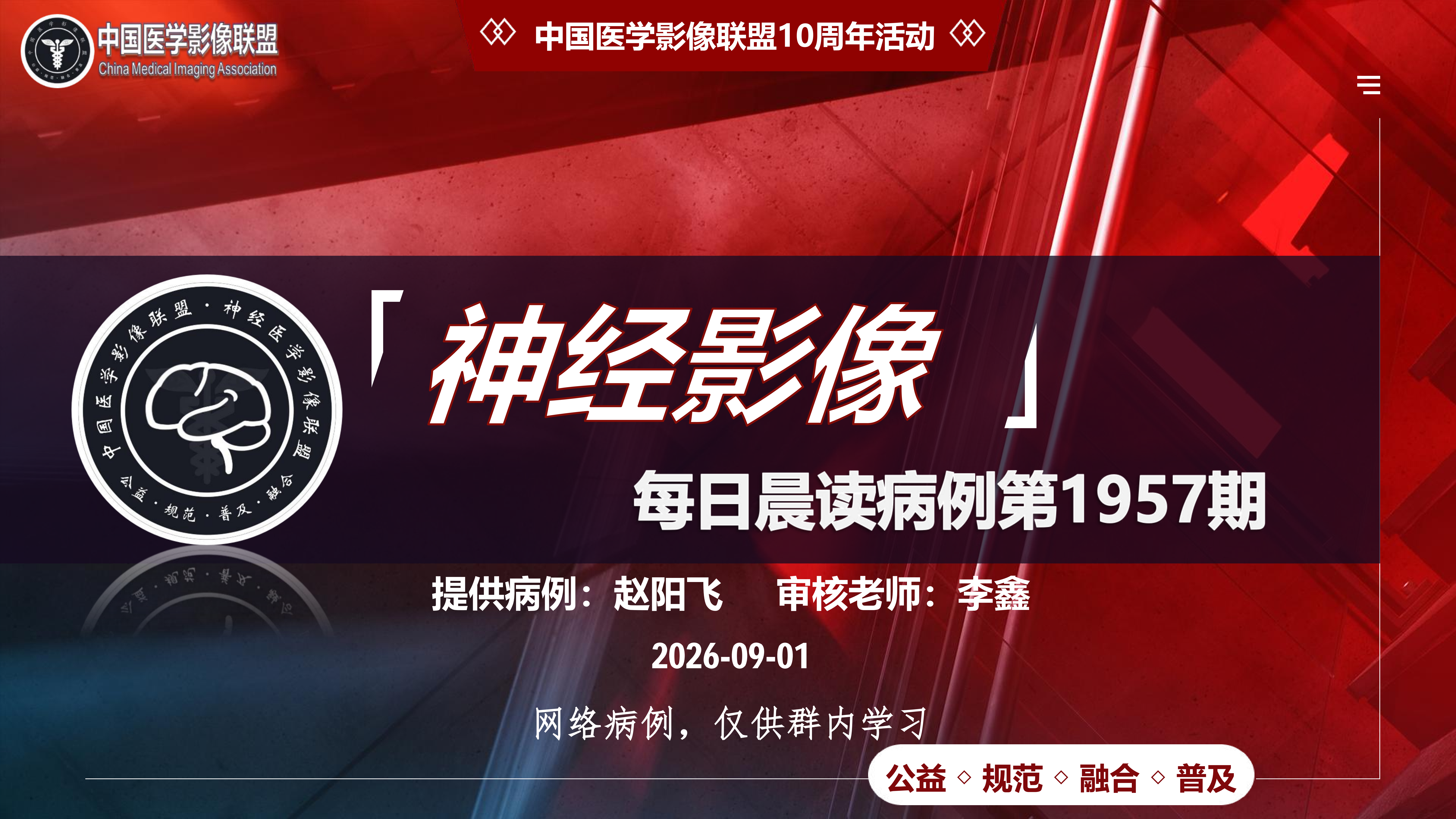 中影神经每日一例第1957期