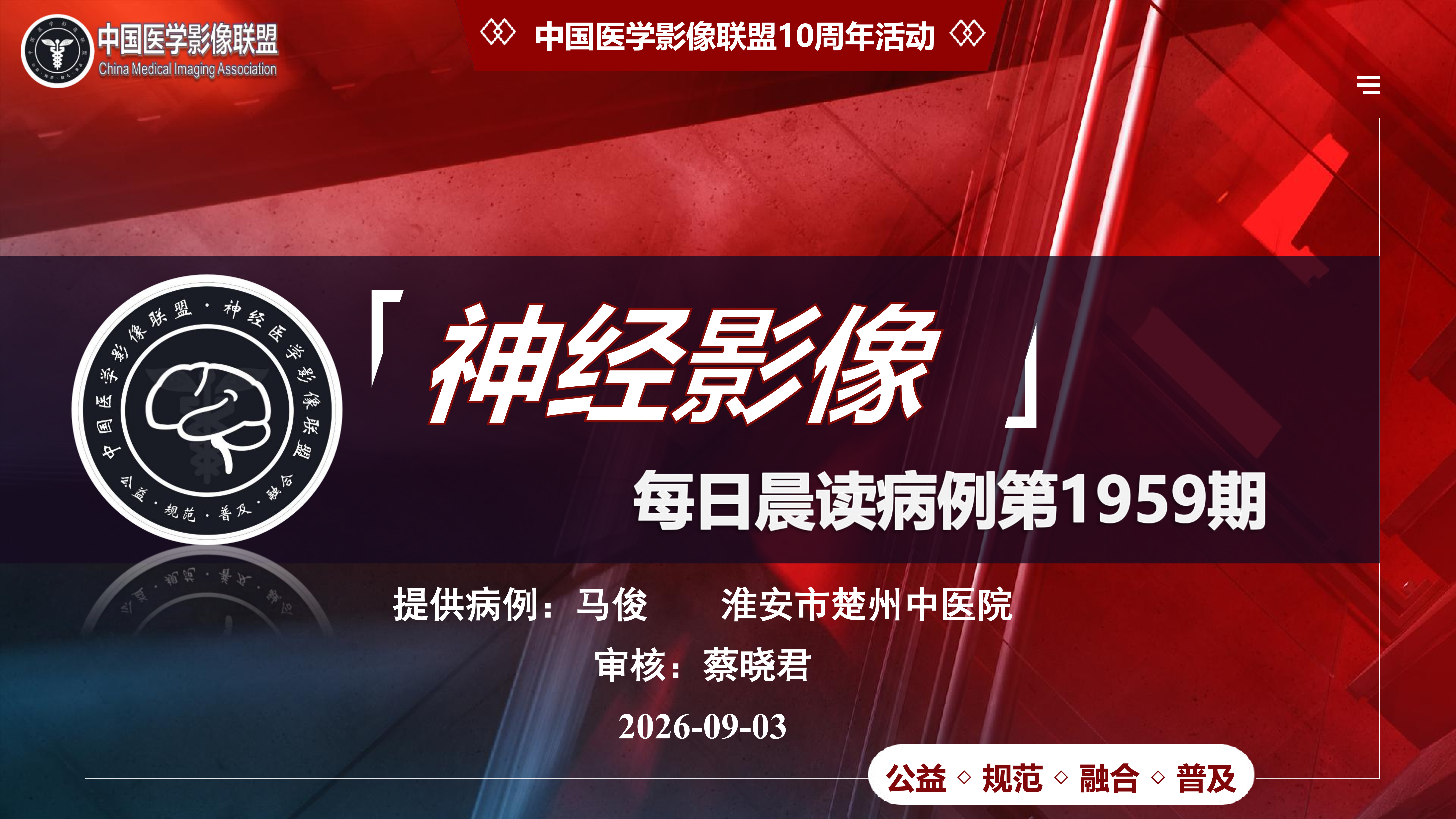 中影神经每日一例第1959期