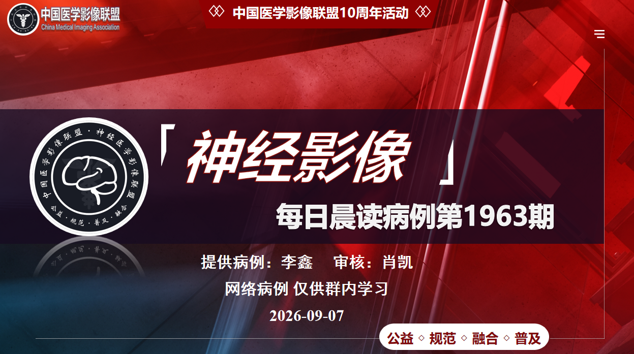 中影神经每日一例 第1963期