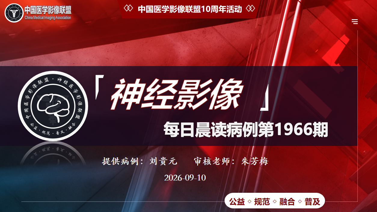 中影神经每日一例1966期