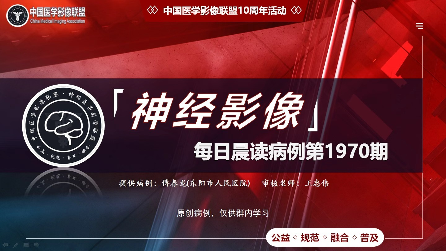 中影神经每日一例 第1970期