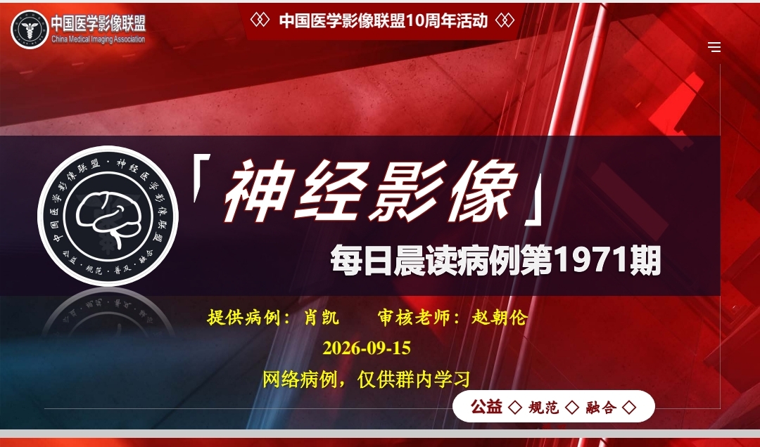 神经群每日一例第1971期