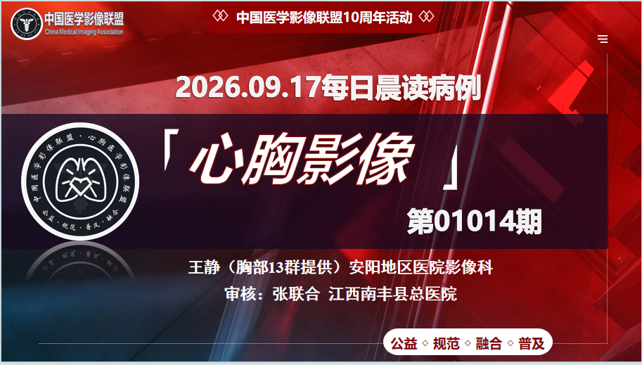 中影联盟-胸部病例晨读第01014期