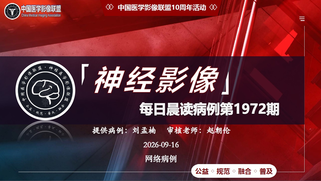 中影神经每日一例 第1972期