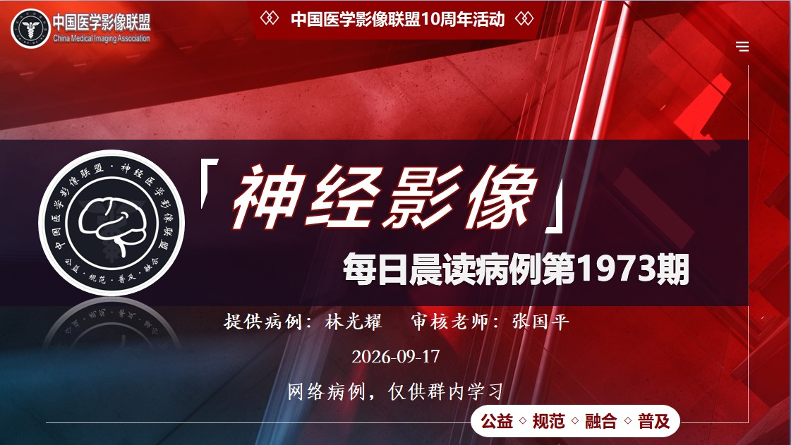 中影神经每日一例第1973期