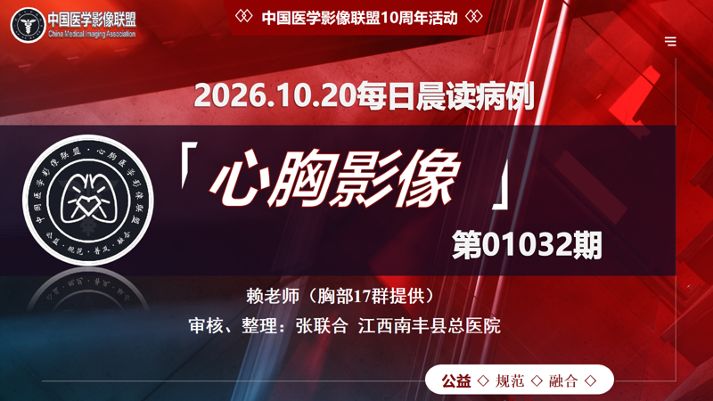 中影联盟-胸部病例晨读第01032期