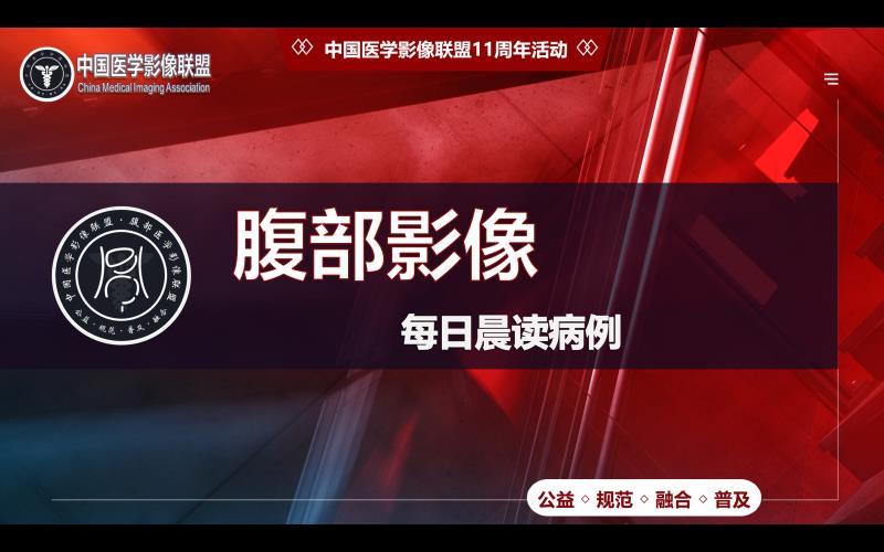 中影联盟腹部读片2078期