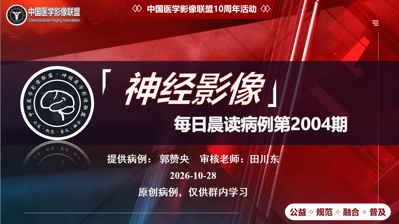 中影神经每日一例第2004期