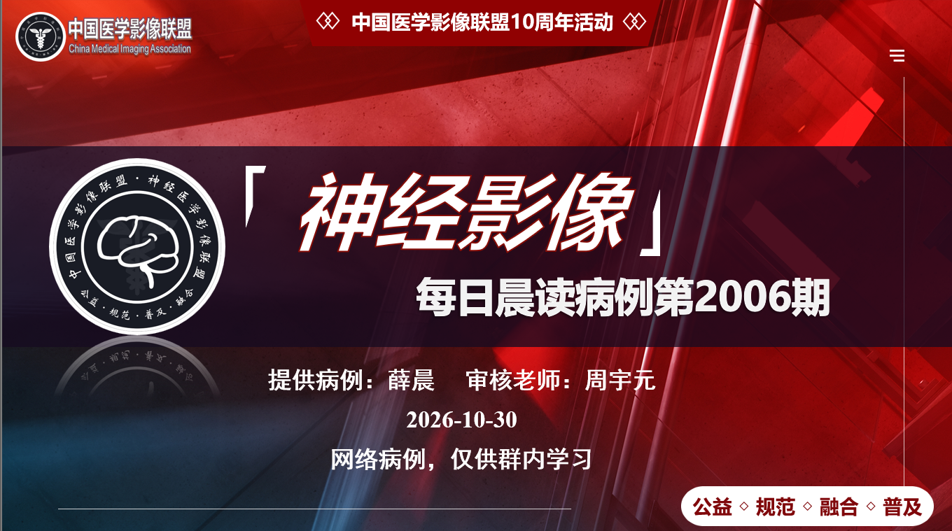 中影神经每日一例第2006期