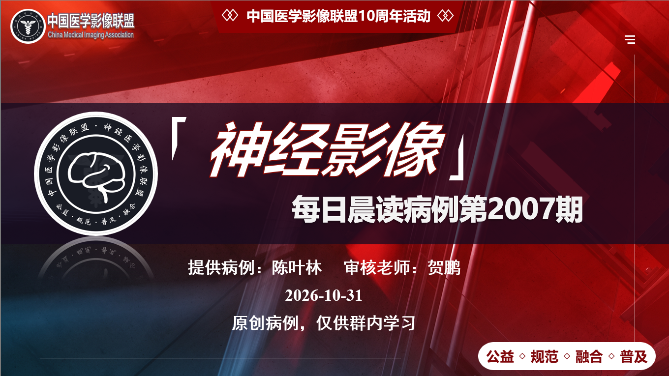 中影神经每日一例第2007期