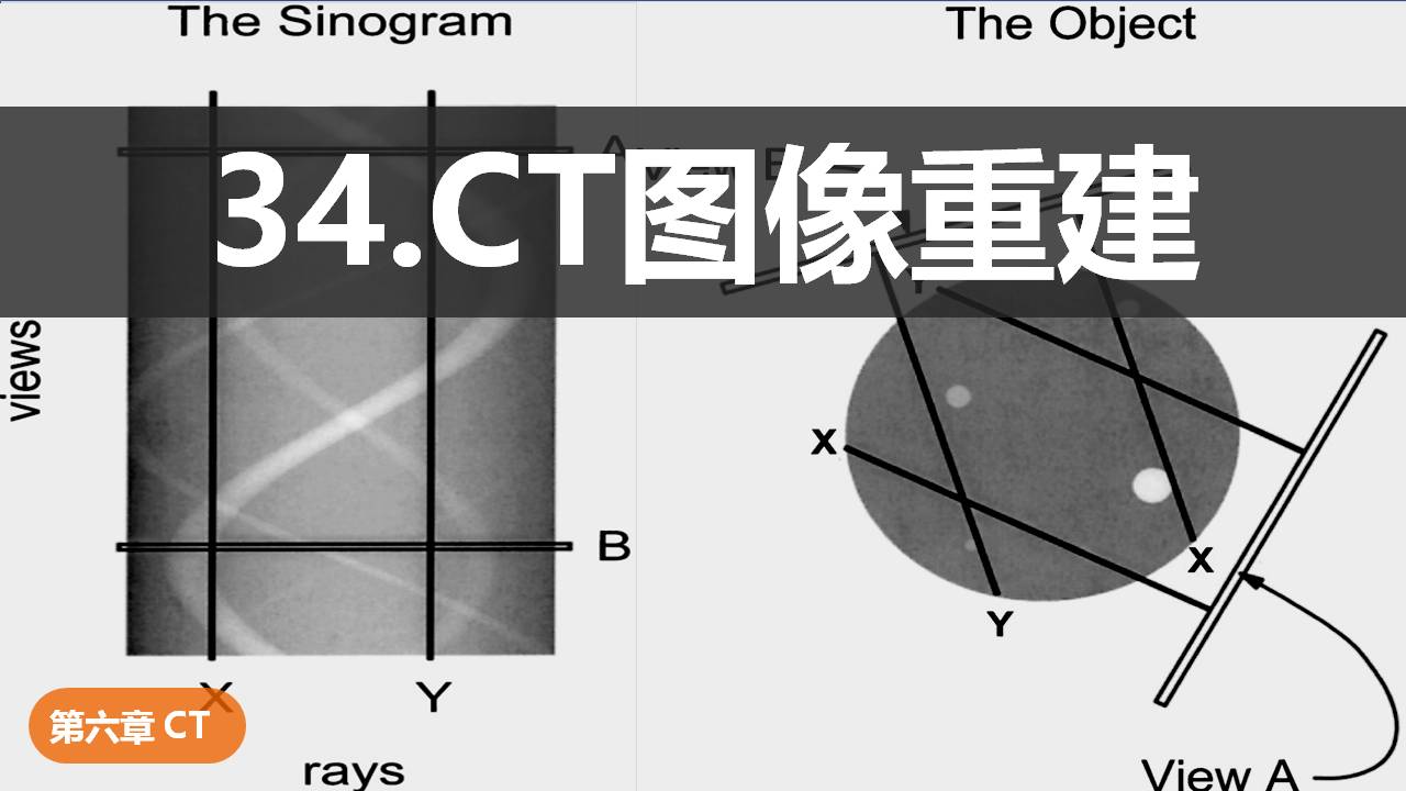 34.CT图像重建-中国医学影像联盟-China Medical Imaging Association